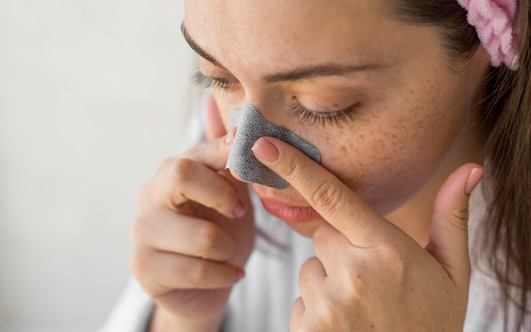 Jak pozbyć się wągrów z nosa? Domowe sposoby i profesjonalne metody na zaskórniki na nosie